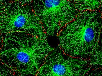 the mission to make more photostable fluorophores