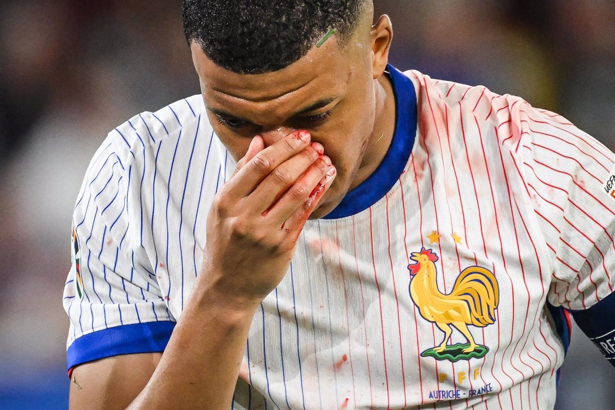 Mbappé sufre una fractura nasal y será operado