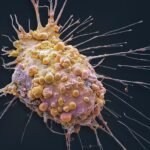 Micrografía electrónica de una célula cancerosa de oligodendroglioma.