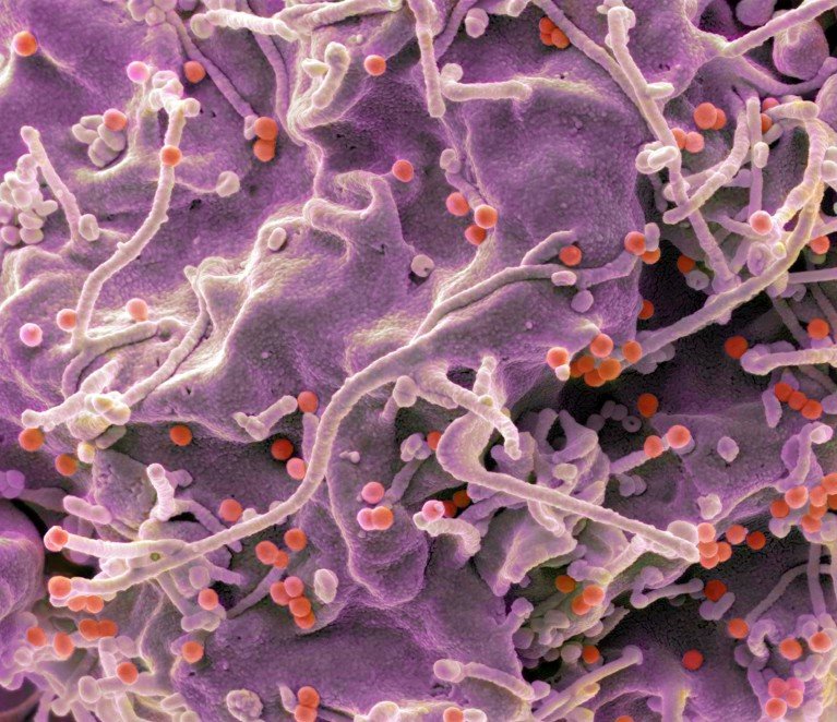 Micrografía electrónica de un cellula 293T infectada con VIH (puntos rojos).